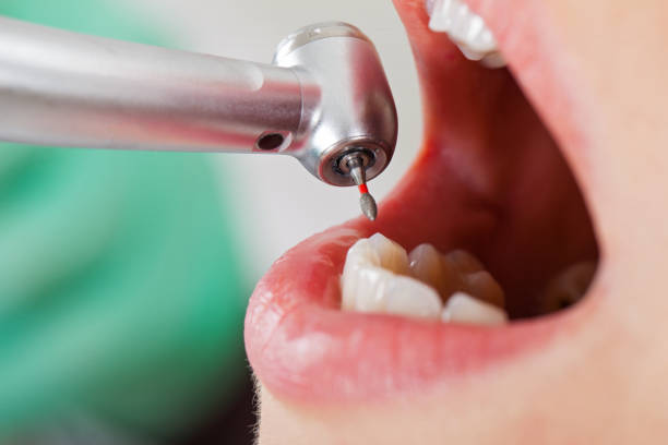 Professional Emergency Dentist in MS